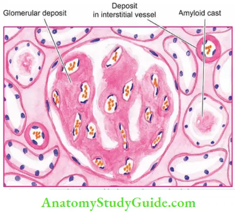 Staining Characteristics Of Amyloid Notes - Anatomy Study Guide