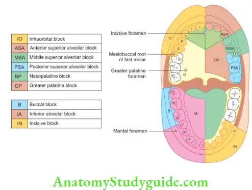 Surgical Endodontics Schematic representation of areas anasthetised by diffrent nerve blocks of local anesthesia.