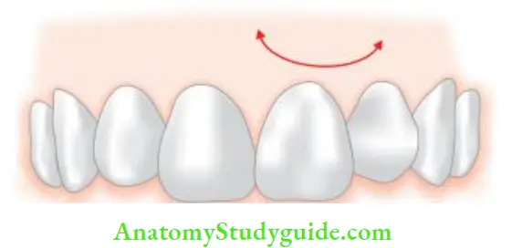 Surgical Endodontics Semilunar flap.
