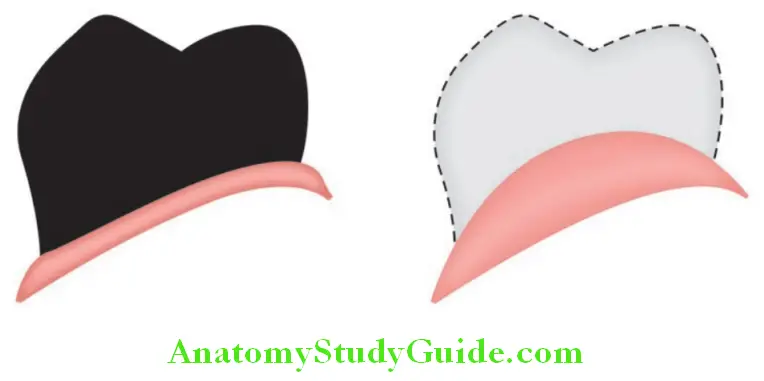 Teeth Selection Brief Overview anatomic tooth