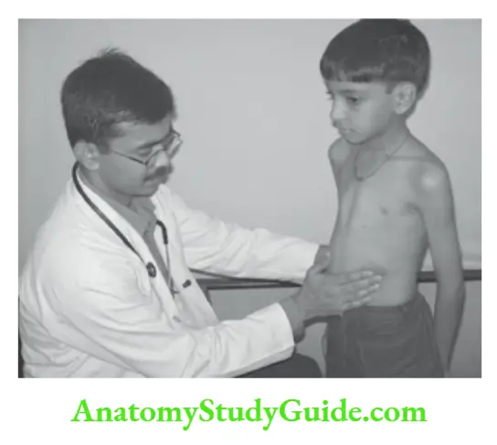 The Alimentary System and Abdomen Examination of abdomen in standing position in a preschool child.