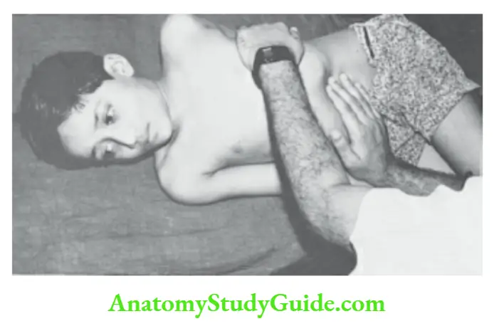The Alimentary System and Abdomen The child is turned to the right lateral position,