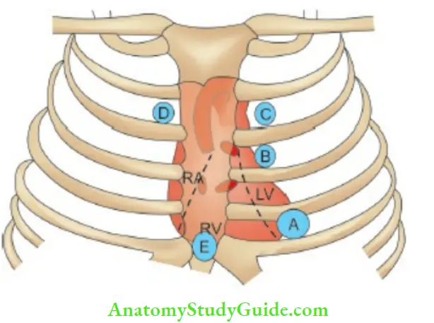 The Cardiovascular System Areas Of Auscultation Of Heart Sounds