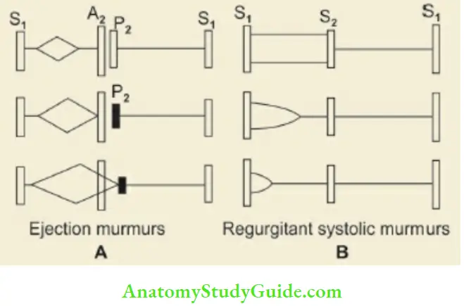 The Cardiovascular System Ejection And Regurgitant Systolic Murmurs
