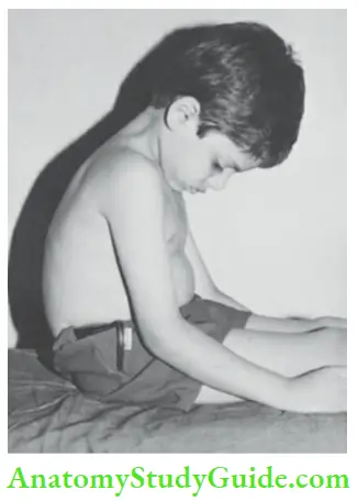 The Central Nervous System Examination For Neck Rigidity Older Child Is Asked To Sit Uo And Touch His Chin To The Front Chest Without Opening His Mouth