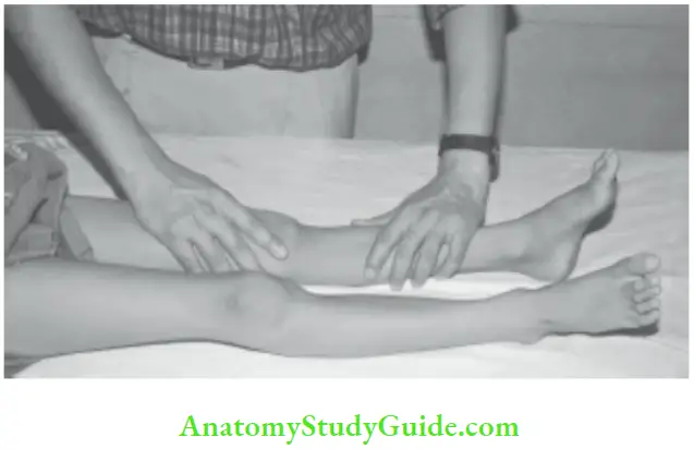 The Central Nervous System Patellar Clonus The Patella IS held Between The Thum And Fingers