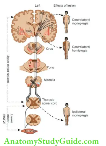 The Central Nervous System Showing Location Of Upper And Lower Motor neurons And Effects