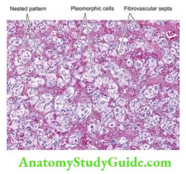 The Endocrine System Pheochromocytoma.