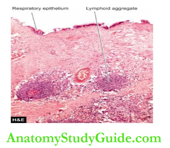 The Eye, ENT and Neck Lymphoepithelial (branchial) cyst.