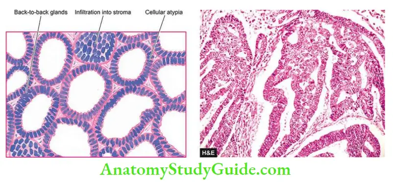 The Female Reproductive Genital Tract Notes - Anatomy Study Guide