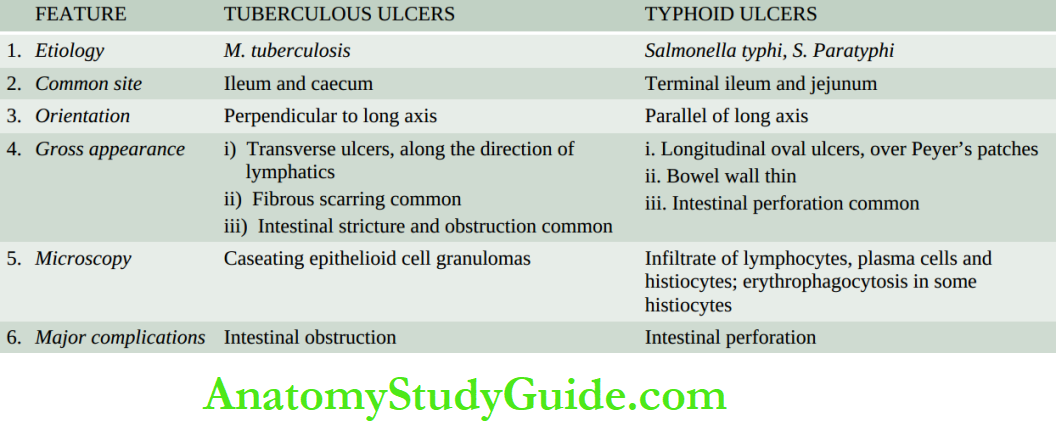 The Gastrointestinal Tract Salient contrasting features of tuberculous and typhoid ulcers of small intestine