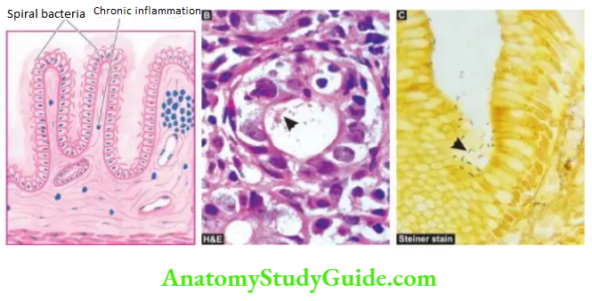 The Gastrointestinal Tract histologic apperance of H