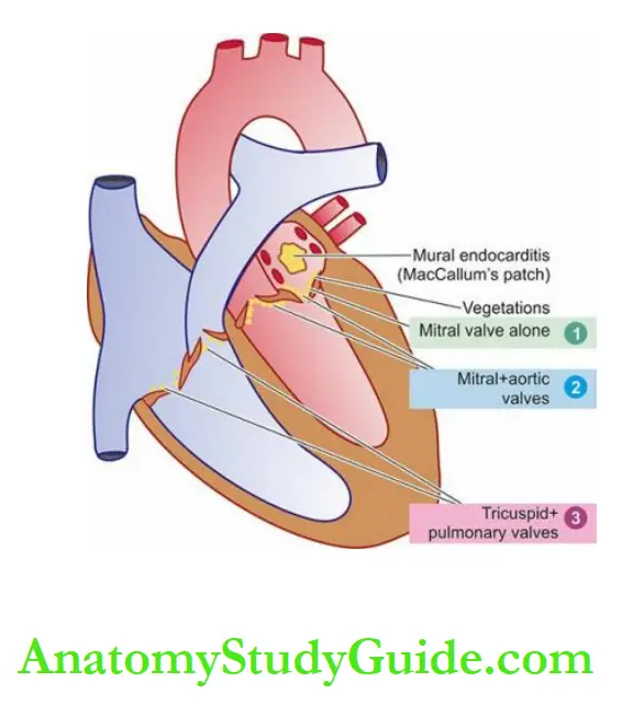 The Heart Schematic representation of the anatomic regions