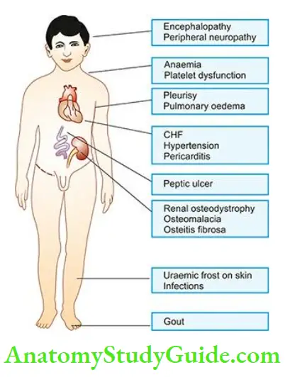 The Kidney and Lower Urinary Tract Clinical manifestations in chronic kidney disease.