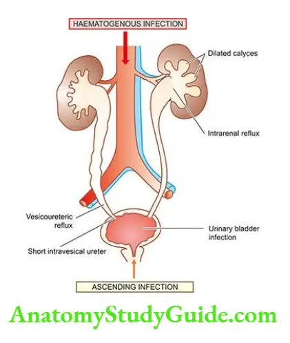 The Kidney and Lower Urinary Tract Pathogenesis of reflux nephropathy.