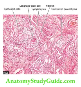 Inflammation: Definition, Diseases, Types, and Treatment - Anatomy ...