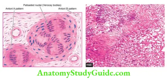 Pathology of The Nervous System Notes - Anatomy Study Guide