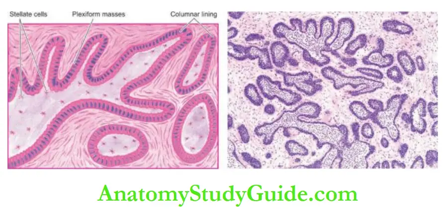 The Oral Cavity and Salivary Ameloblastoma