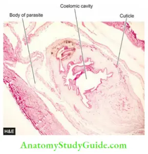 Torch Complex Notes - Anatomy Study Guide