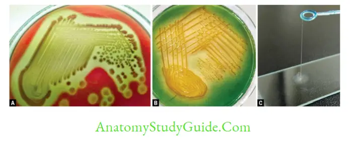 Vibrio Vibrio cholerae on blood agar (hemodigestion); B. TCBS agar with yellow colored colonies of Vibrio
