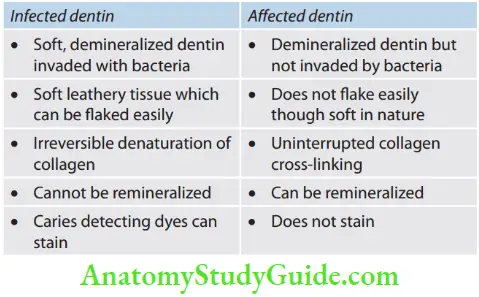 Vital Pulp Therapy Difference Between Infected And Affected Dentin