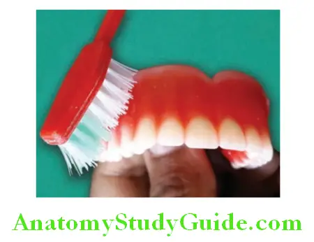 Wax Up Of Complete Denture finishing of roots with mild pressure
