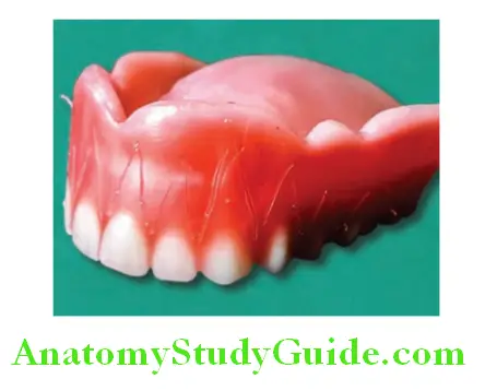 Wax Up Of Complete Denture root markings placement