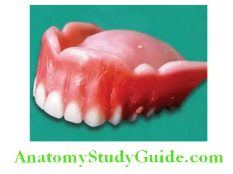 Wax Up Of Complete Denture shaping the roots according to markings