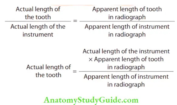 Working Length Determination calculate actual length of the tooth