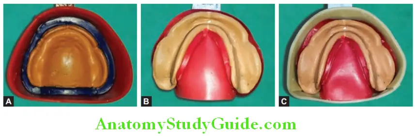boxing maxillary and mandibular impression
