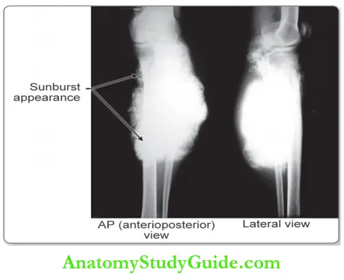 Bone X-ray Of The Knee Joint