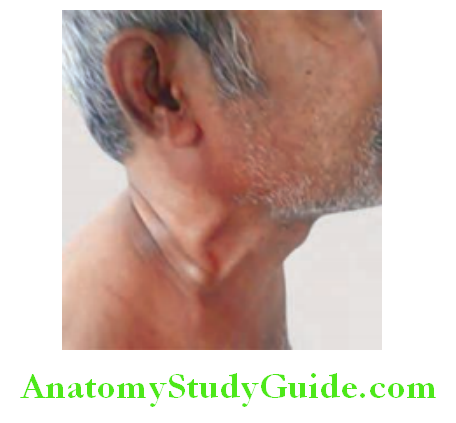 Cardiology Prominent jugular veins