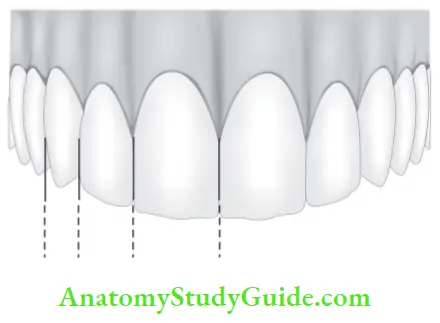 Complete dentures Application of golden proportion in dental esthetics