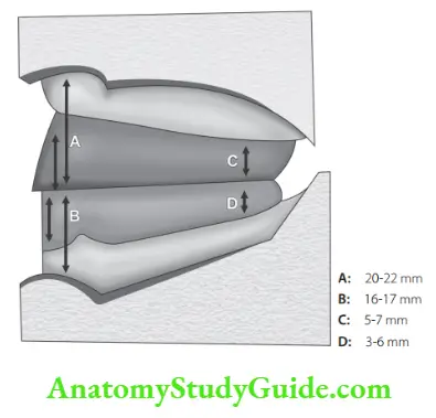 Complete dentures Dimensions of maxillary and mandibular occlusal rims
