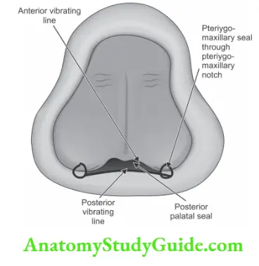 Complete dentures Posterior palatal seal