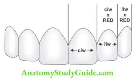 Complete dentures REd proportion