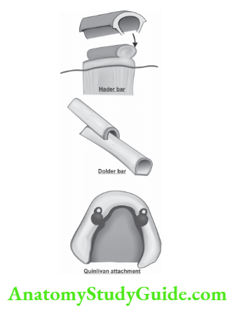 Complete dentures diffrent types of attachments