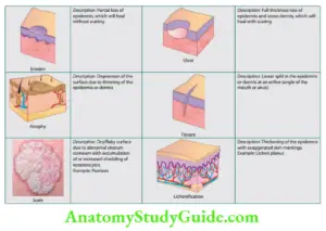 Venereology Question and Answers - Anatomy Study Guide