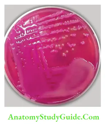 Enterobacteriaceae Klebsiella