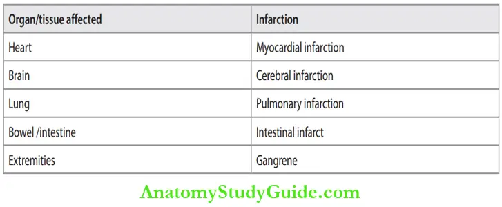 Hemodynamic Disorders Common And Important Infarcts