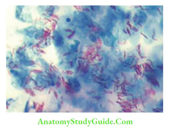 Mycobacteria The picture below depicts a bacterium which is most consistent with Mycobacterium tuberculosis