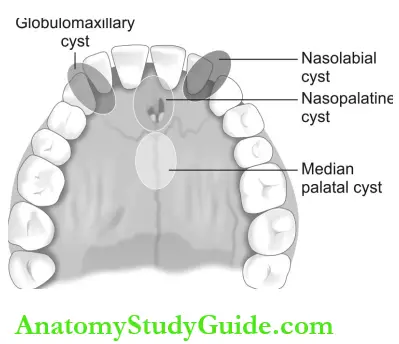 Odontogenic And Nonodontogenic Cysts - Anatomy Study Guide