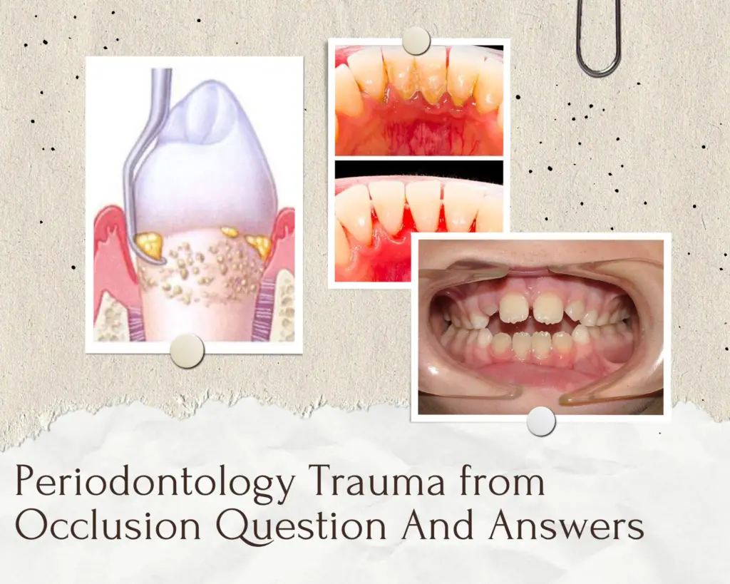 Periodontology Trauma from Occlusion Question And Answers Anatomy