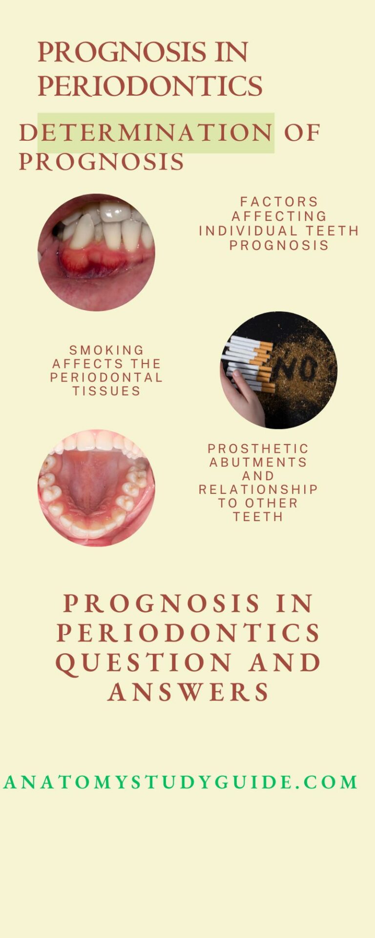 Prognosis in Periodontics Question And Answers Anatomy Study Guide