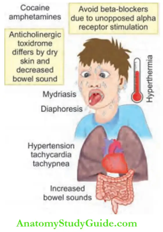 Toxicology Symapthomimetc toxidrome