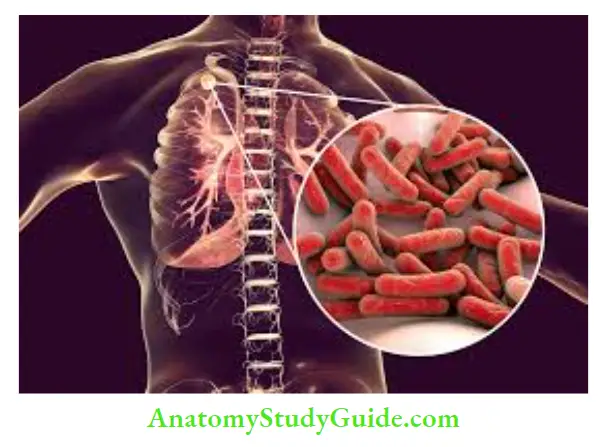 Bacterial, Viral, And Fungal Infections In Mouth Tuberculosis