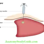 Biopsy And Healing Of Oral Wounds Biospy
