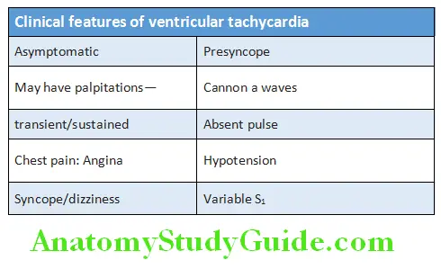 Cardiology Clinical features of ventricular tachycardia