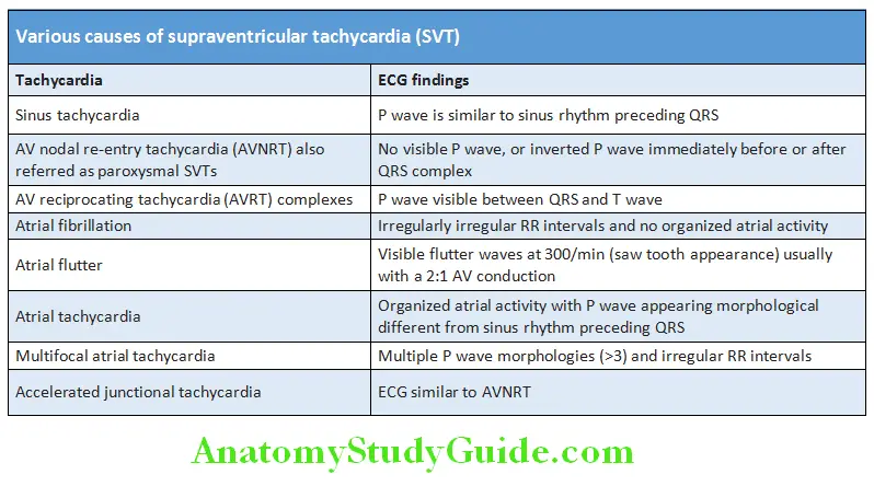 Cardiology Various causes of supraventricular tachycardia (SVT)