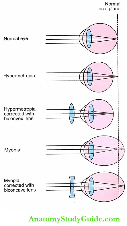 Errors of Refraction Physiology Notes - Anatomy Study Guide